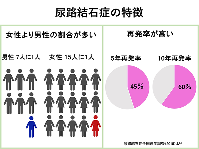 尿路結石症の特徴