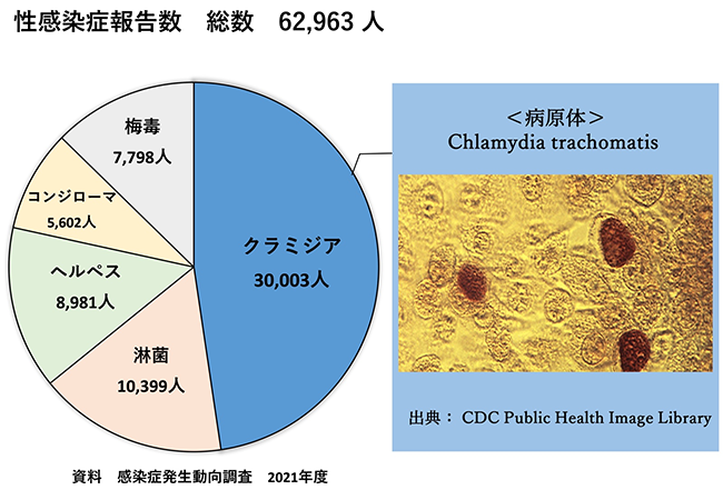 クラミジア感染症報告数