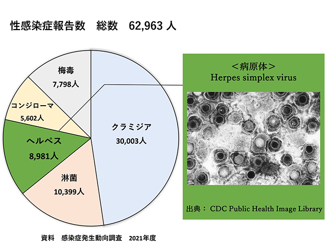 性器ヘルペス報告数