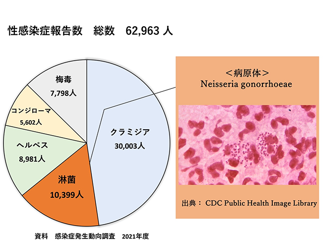 性感染症報告数