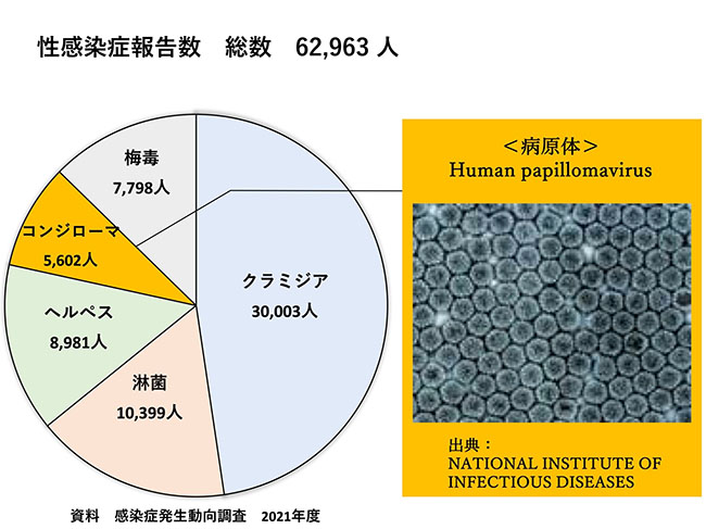 コンジローマ報告数