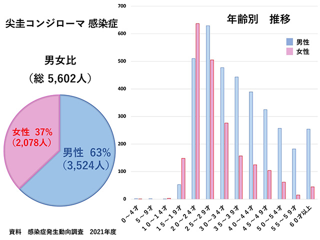 コンジローマ感染症